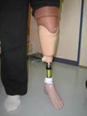 T.S.B式骨格構造下腿義足（自己懸垂機能義足）Iceross　Systemの写真